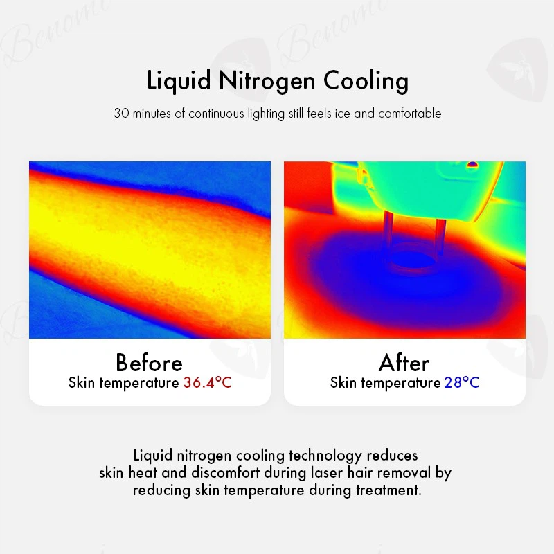 Liquid nitrogen cooling Liquid nitrogen cooling