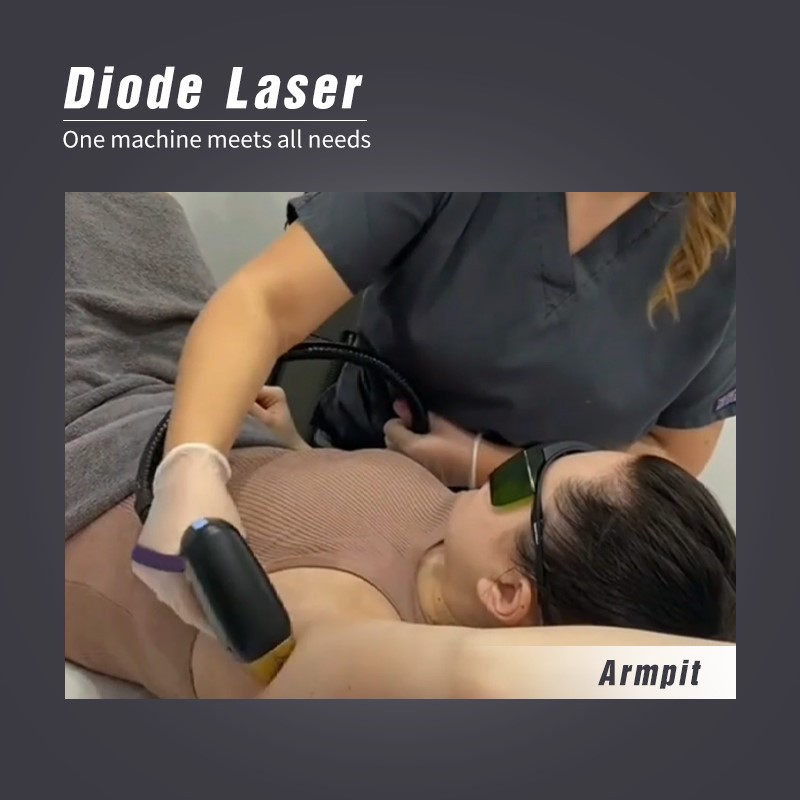 hair removal