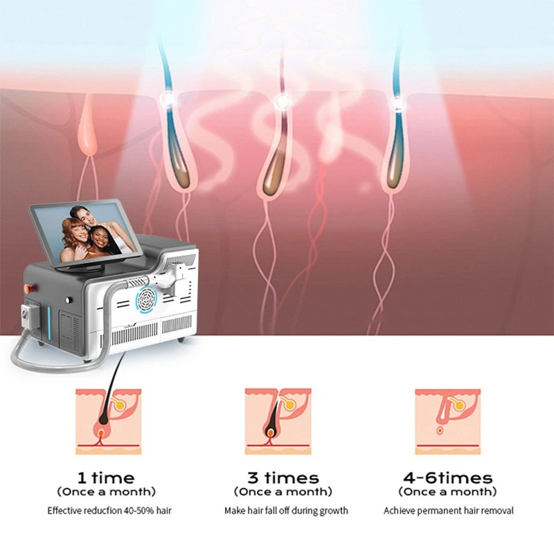 Portable Laser Hair Removal Machines